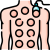 cupping