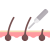 depilation